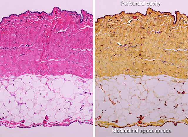 e-heart-cardiovascular-pathology-home-page